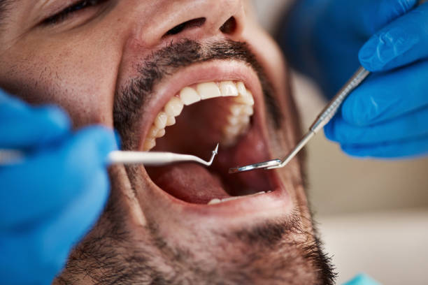 Best Tooth Infection Emergency Dentist  in Homestead Meadows North, TX